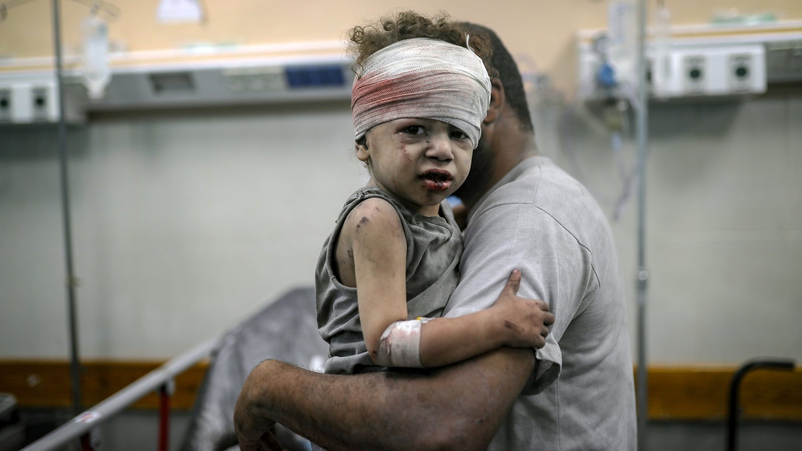 el hospital de Gaza desbordado con la llegada de niños heridos